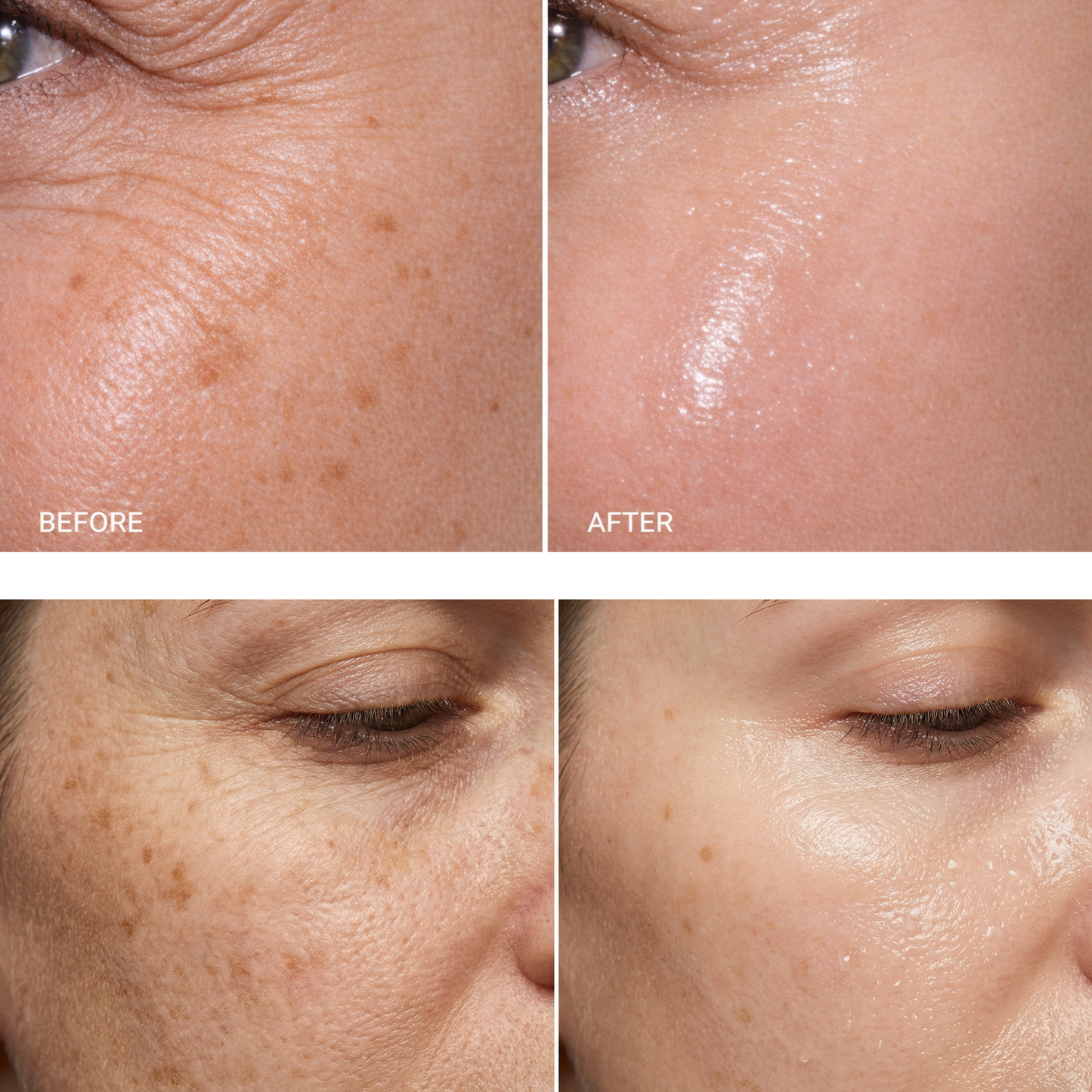 PDRN Microneedle Essence