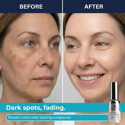 PDRN Microneedle Essence