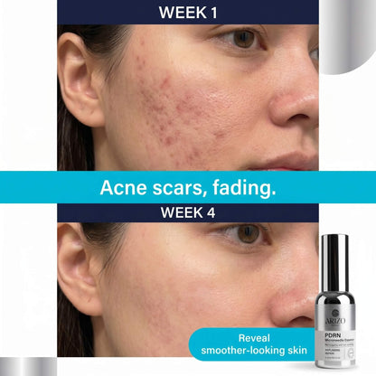 PDRN Microneedle Essence
