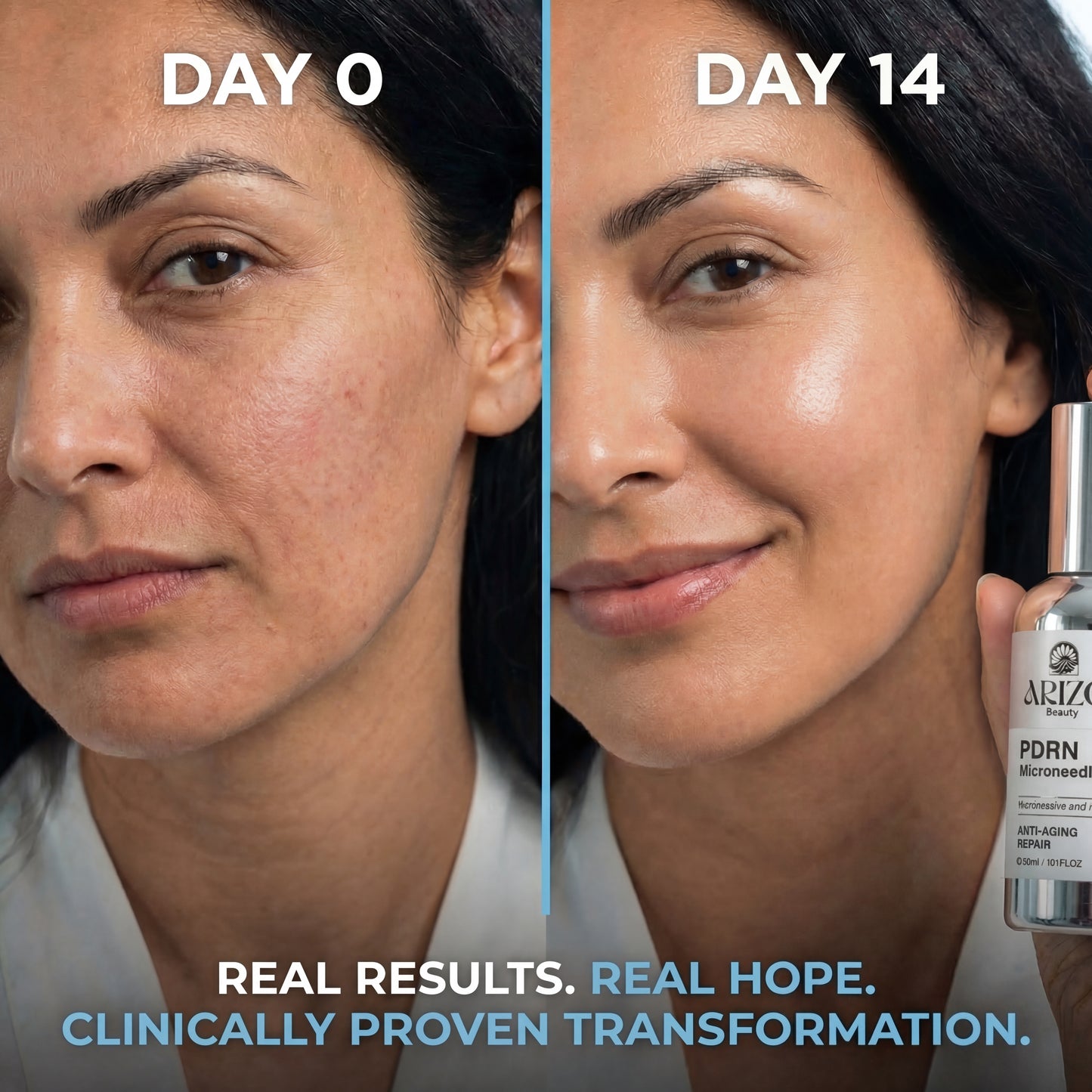 PDRN Microneedle Essence